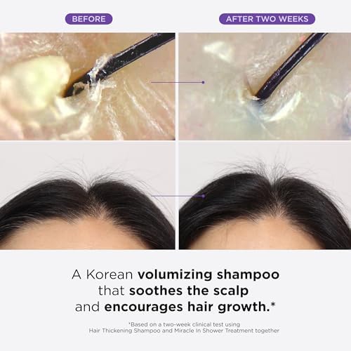 Dr. Groot Hair Thickening Shampoo, Korean Hair Care with Biotin, Rosemary Oil to Help Volumize Thinning, Damaged Hair, Hydrate Hair and Scalp, Biotin Shampoo, Scalp Revitalizing Solution