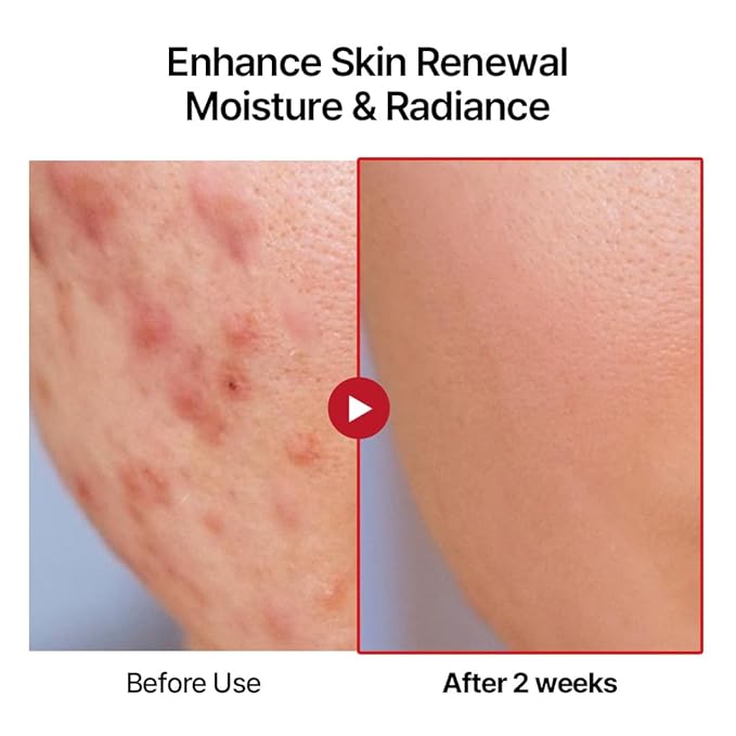 Swanicoco PDRN Hydrating Repair Ampoule Serum Powerful Anti Aging Face and Neck for Skin Turnover Skin Regeneration Wound Healing Korean Skincare, Stocking Stuffer 30ml 1Fl Oz