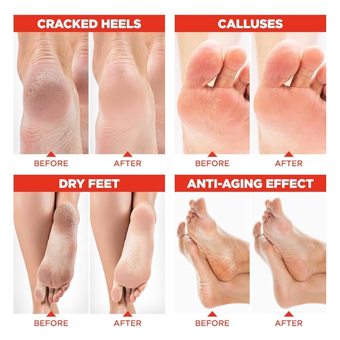Lavinso Foot Mask that Removes Dead Skin and Callus - 2 Pack - Peach Feet Peeling Mask Extra Strength