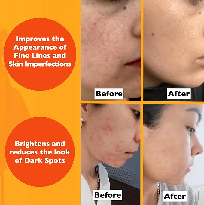 Vitamin C Serum For Face – Anti-Aging Facial Serum with Vitamin C, Hyaluronic Acid, Niacinamide, B5 & Vit E. Brightening Facial Essence for Dark Spots, Fine Lines, Wrinkles & Glowing Skin, 2 Fl Oz