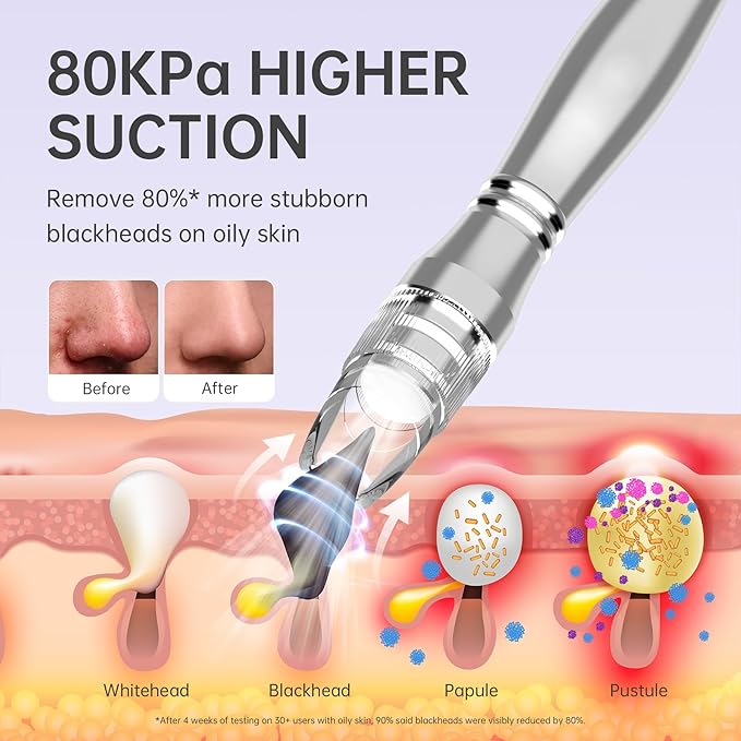 UNOISETION Blackhead Vacuum Removers, 2 in 1 Pro-Grade at-Home Spa Facial Vacuum Pore Cleaner for Blackheads, Whiteheads, Exfoliation, 20-80 Kpa Adjustable Suction for All Skin Types, White