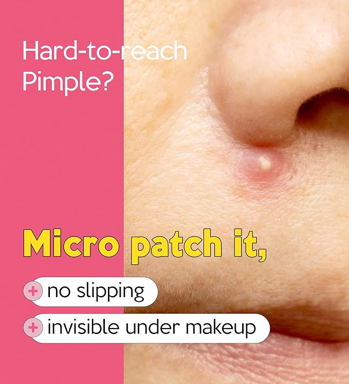 Troubless Invisible Plus Spot Patch The Micro Signature - Thin Hydrocolloid for Seamless Coverage - Comfortable & Easy-Wear Patches for Face (0.8cm & 1cm, 123 ea)