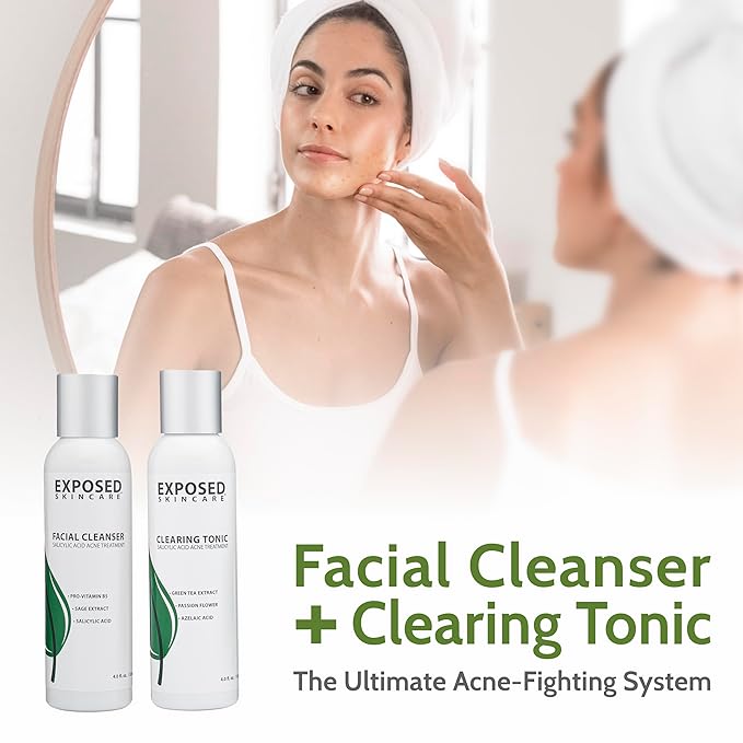 Exposed Skin Care, Acne Treatment Kit with 2.5% Salicylic Acid and 3.5% Benzoyl Peroxide to Clear Up Teen, Adult, Hormonal and Cystic Acne – Natural, Non-toxic and Cruelty Free