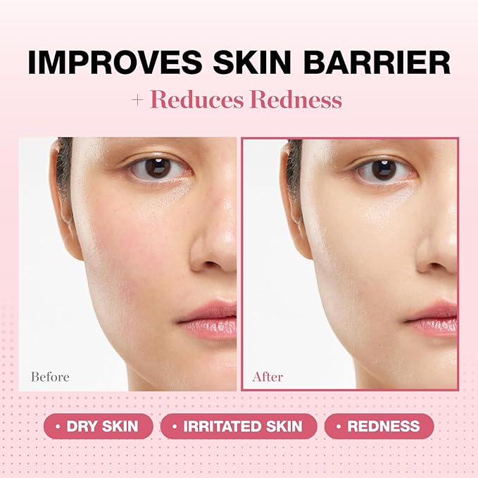 Physiogel Redness Reducing Cream – Ceramide Moisturizer for Dry, Sensitive & Redness-Prone Skin, Repairs Skin Barrier, Dermatologist-Tested, Fragrance-Free, Korean Skincare, 3.4 fl oz