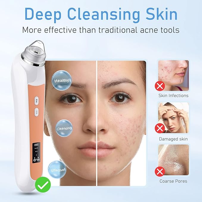 Facial Pore Blackhead Remover Vacuum, 1080P Camera Blackhead Remover, 20x Zoom, 8 LEDs ＆ 3 Suction Modes, 800mAh Battery & USB - 6 Heads Pore Cleaner Kit for Women&Men(Orange)