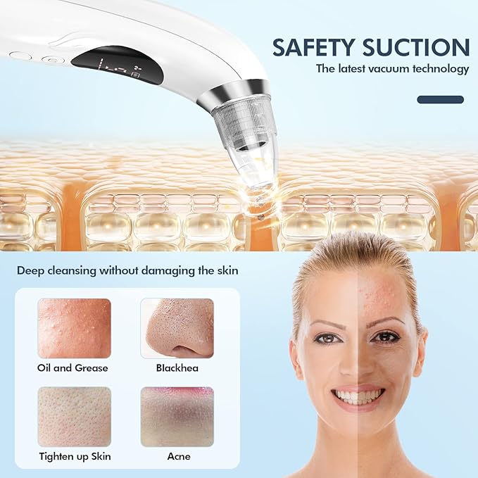 Blackhead Remover Pore Vacuum, Upgraded Black Head Remover for Face, Electric Acne Comedone Whitehead Extractor Tools-5 Suction Power, 5 Probes, USB Rechargeable Pimple Popper Tool Kit