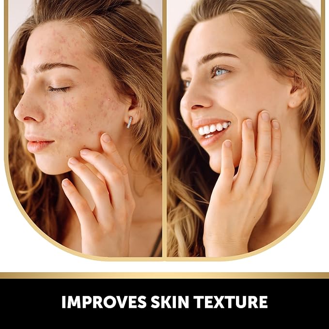 VALITIC Kojic Acid Soap for Hyperpigmentation - with Glutathione, Collagen & Vitamin C - Natural Soap Bars with Turmeric - Original Japanese Complex for Dark Spot Correction - 2 Pack