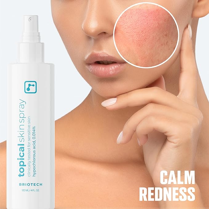 BRIOTECH Topical Skin Spray, Hypochlorous Acid Spray for Sensitive Skin, HOCl Facial Mist, Full Body Support Against Irritation, Calm Redness, Soothe Foot & Scalp, 4 oz
