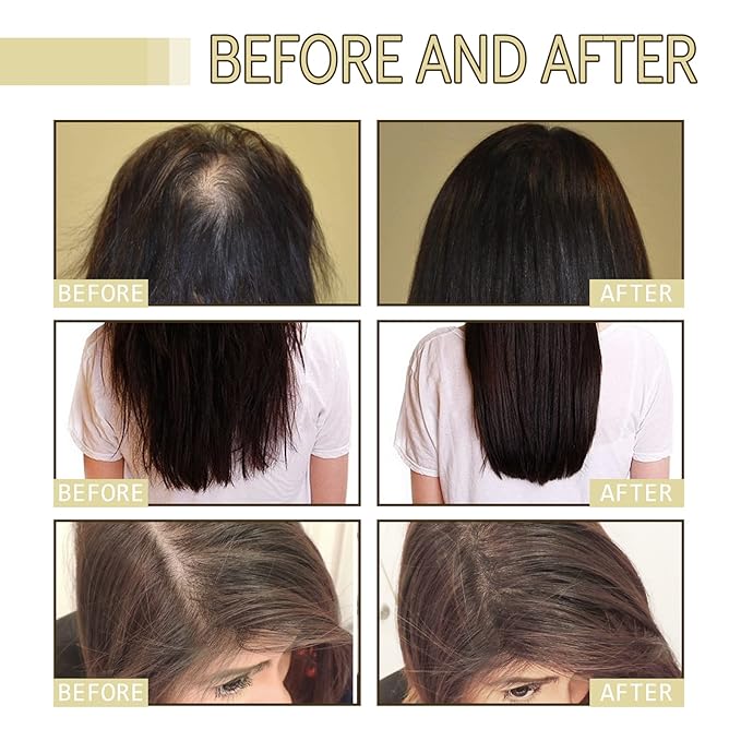 Rosemary Hair Growth Oil for Dry, Damaged & Thin Hair, Nourishing Unisex Formula (3 x 60ml)