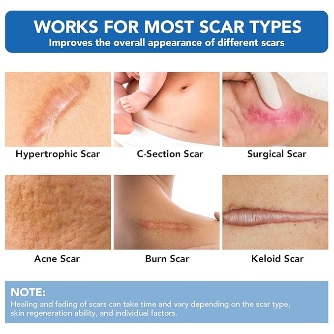 Silicone Scar Sheets, Silicone Scar Tape(1.6"x 120" Roll-3M) - Reusable, Soft & Medical Grade Adhesive Tape for Old & New Scars, C-Section, Surgery, Keloid & Acne Scars