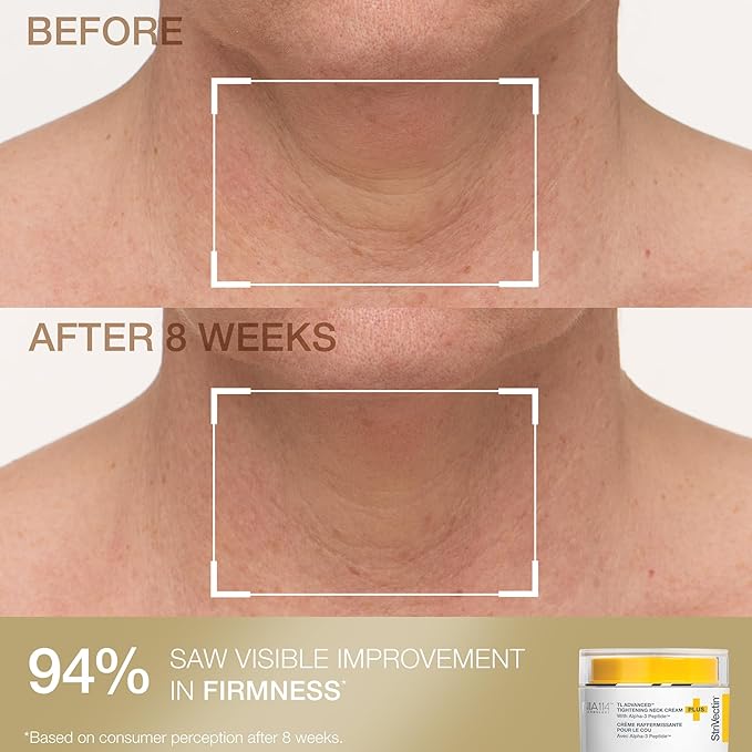 StriVectin Tighten & Smooth Neck Cream and Neck Serum Roller Anti-aging Skin Care 2-Piece Set, Smoothing Look of Wrinkles and Fine Lines, Improves Crepey Skin and Vertical Lines