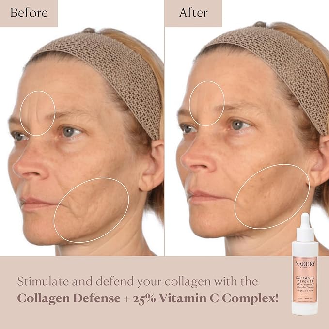 Nakery Collagen Defense Face Serum, 25% Vitamin C Complex with Niacinamide and Peptides, Anti Aging Collagen Booster for Wrinkles and Dark Spots, Brightening Skin Treatment, Made in USA