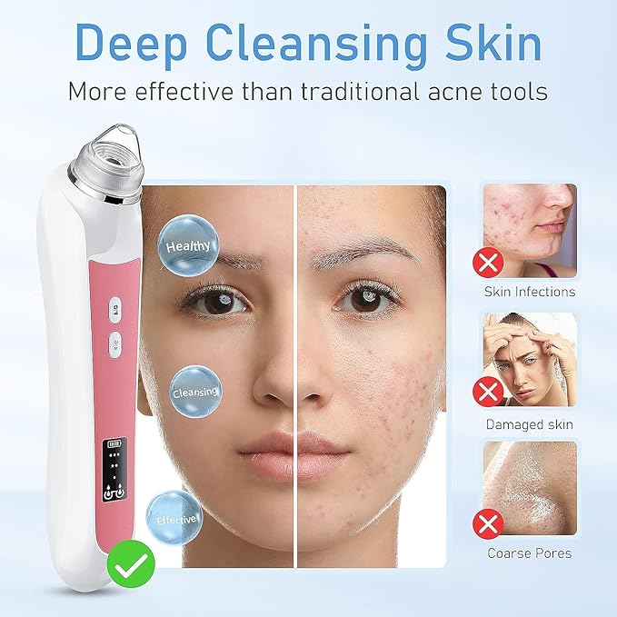 Blackhead Remover Vacuum, USB Interface Type Pore Vacuum, Black Head Extractions Tool with Camerafor, Men and Women Pore Cleaner, 3 Adjustment Modes & 6 Suction Heads(Light Pink)