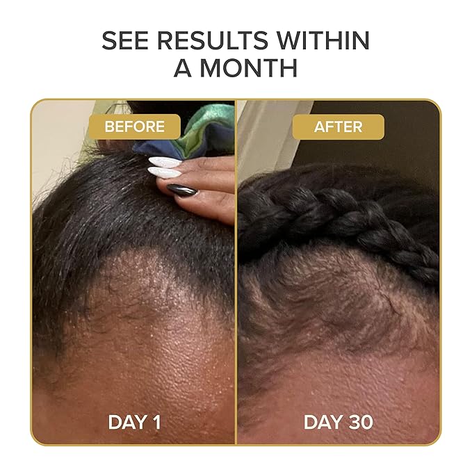 Shedavi Iconic Vegan Hair Serum with Botanicals - Growth Treatment for Women & Men's Dry, Damaged Hair and Scalp with Argan, Coconut, Castor, and Tea Tree Oils