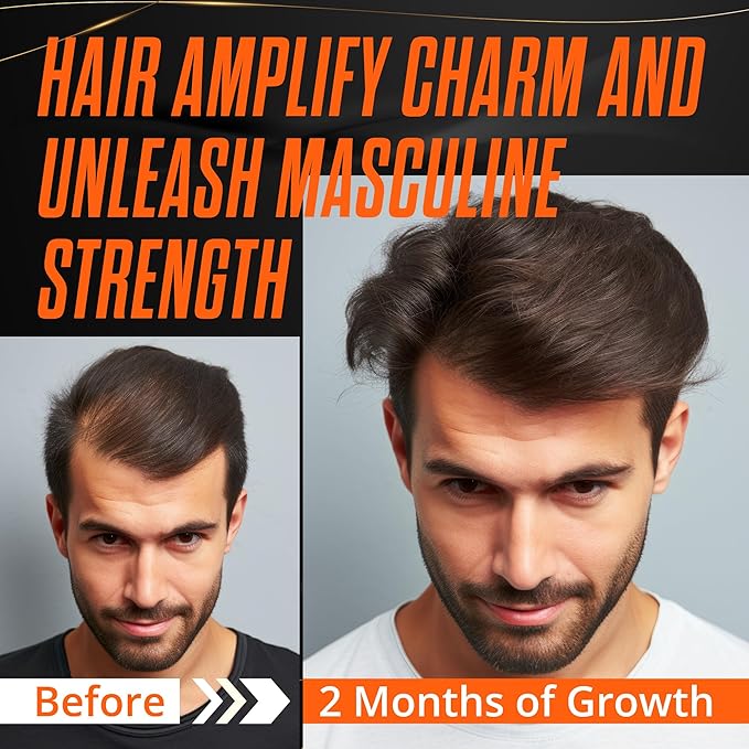 Abera Hair Growth Serum - Natural Regrowth Treatment for Hair & Beard with Biotin & Castor Oil, Economy Combo (3 Serums + Gift)