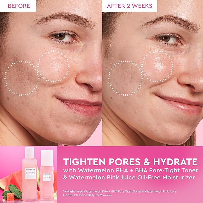 Glow Recipe Pink Juice Water Gel Face Moisturizer for Women, Men & Teens, Travel Size - Hydrating Hyaluronic Acid, Radiance Boosting, Oil-Free, Long-Lasting Korean Skin Care for Oily Skin (25ml)
