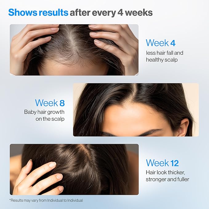 Be Bodywise Rosemary Hair Growth Serum Roll On 25 ml – 3% Rosemary, 3% Redensyl & 2% Anagain | DHT-Blocking Scalp Serum Boosts Oxygen Flow, Reduces Hair Fall | Paraben/Sulfate-Free | Women & Men