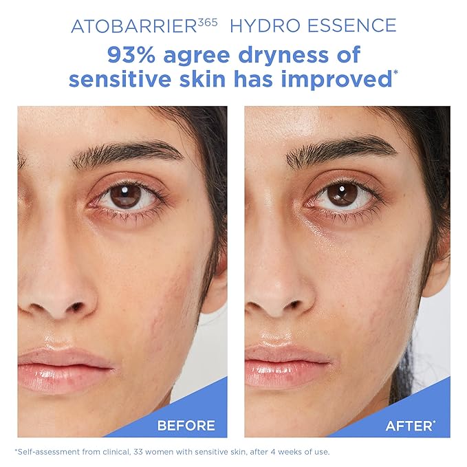 AESTURA ATOBARRIER365 Hydro Essence with Hydrating Amino Acids | Lightweight Formula, Deep Hydration, Suitable for Dry & Sensitive Skin, Non-Comedogenic, 100ML / 3.38 fl. oz.