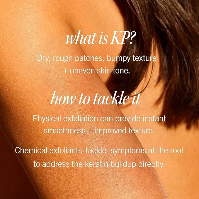 First Aid Beauty - KP Bump Eraser Body Scrub with 10% AHA, Keratosis Pilaris Exfoliator with Glycolic and Lactic acids, Helps Reduce Chicken Skin Bumps, Safe for Sensitive Skin, Peach Scent (8 oz)