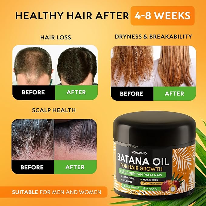 Batana Oil for Hair Growth - 100% Raw & Organic Dr Sebi Batana Oil - Cold-Pressed & Pure Unrefined Batana Hair Mask for Women & Men - Enhances Hair Thickness, Prevents Loss