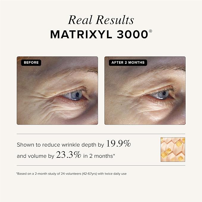 Asterwood Triple Repair Matrixyl 3000 + Argireline + Hyaluronic Acid + Vitamin C Serum for Face - Anti-Aging, Collagen Boosting, Hydrating - Fragrance-Free - 8 Fl Oz