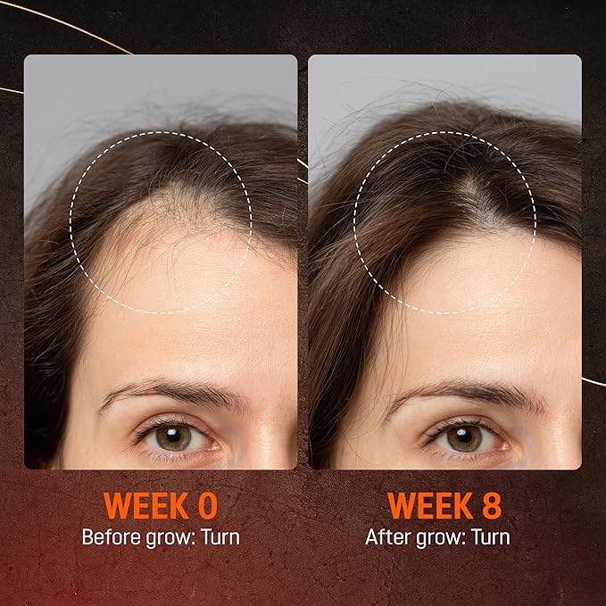 Abera Hair Growth Serum 1.69 fl oz for Hair Loss, Natural Hair Regrowth Treatment for Hair & Beard with Biotin & Castor Oil | Extra Strength & Bigger Size