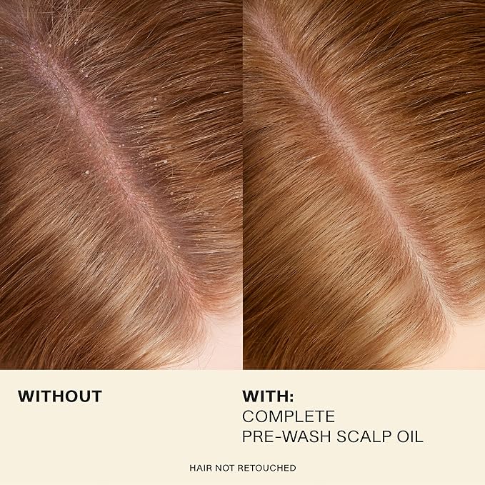 JVN Complete Pre-Wash Scalp Oil, 1.7 Fl Oz, Hair Treatment and Scalp Clarifying Oil Made with Rosemary Extract, Hair Care for Women and Men, Silicone Free