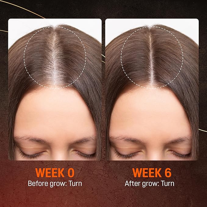 Abera Hair Growth Serum 1.69 fl oz for Hair Loss, Natural Hair Regrowth Treatment for Hair & Beard with Biotin & Castor Oil | Extra Strength & Bigger Size